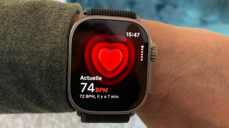 Apple triomphe face à AliveCor dans une affaire de brevets pour l&rsquo;Apple Watch