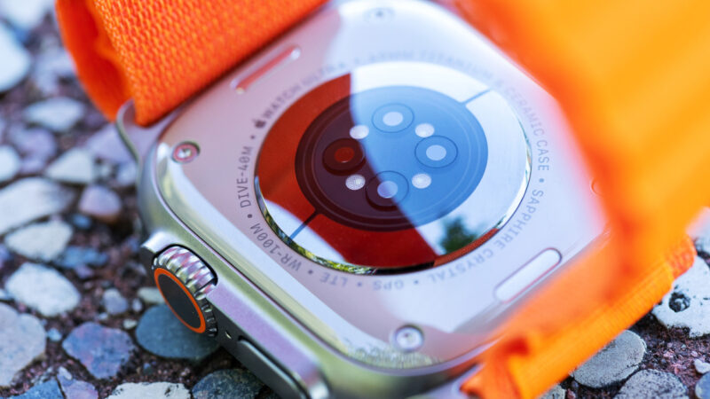 La FDA refuse les capteurs de glycémie sur l&rsquo;Apple Watch