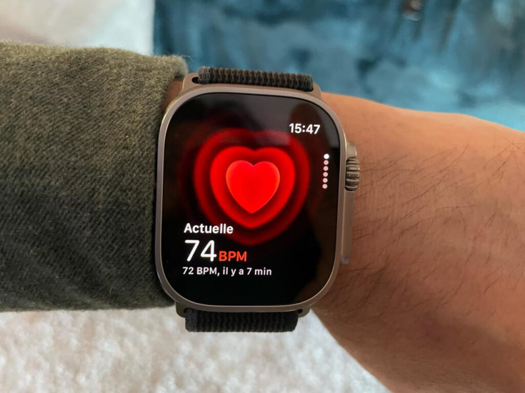 Les douanes américaines soutiennent Apple contre AliveCor : bataille judiciaire compliquée