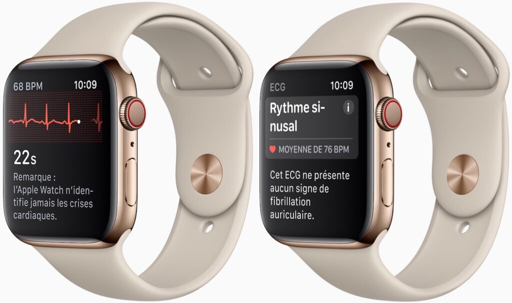 Lapple watch series 10 avec un ecg amélioré et une résistance à l'eau accrue