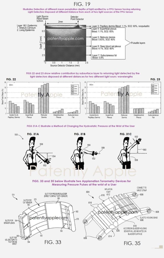 Apple watch : surveillance continue de la pression artérielle en perspective