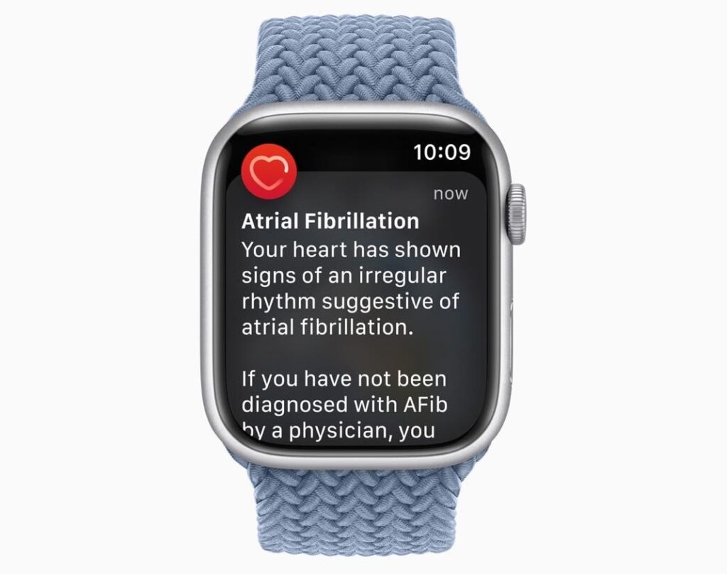 L'apple watch sauve la vie d'un texan en fibrillation auriculaire