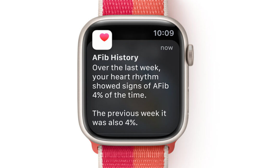 L'efficacité de l'apple watch dans le suivi de la fibrillation auriculaire