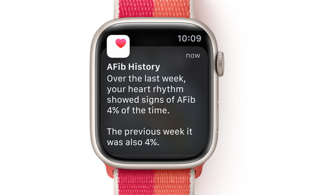 L'efficacité de l'apple watch dans le suivi de la fibrillation auriculaire