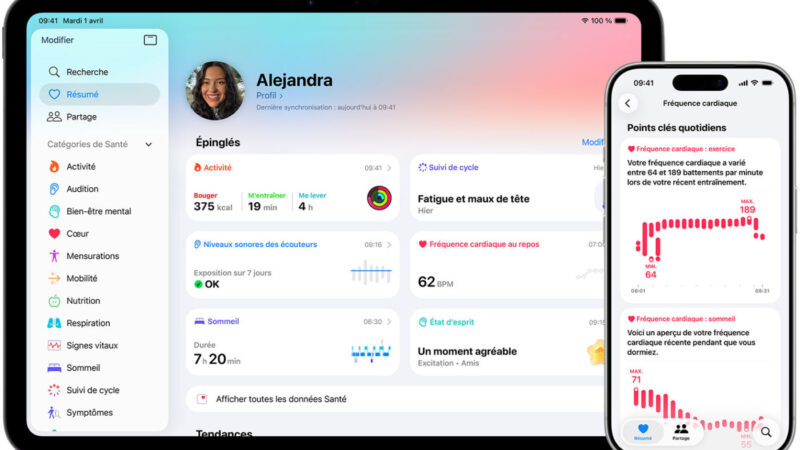 Apple réduit ses ambitions pour son coach santé avec ia