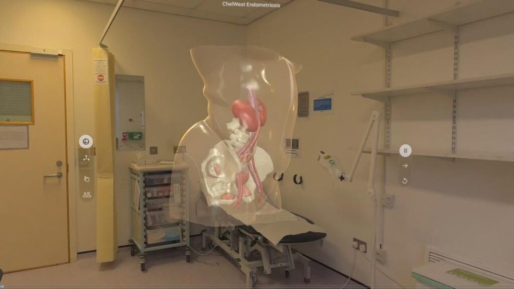 L'apple vision pro révolutionne la préparation des patients à l'opération