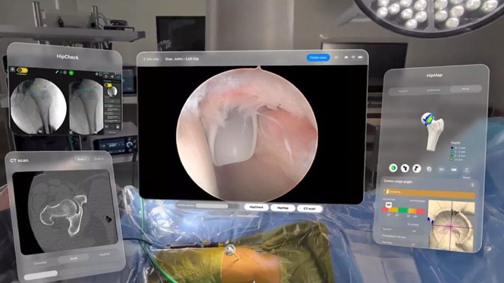 L'apple vision pro entre dans les blocs opératoires